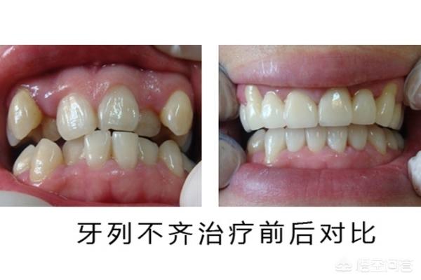 安吉最新24小时牙医在线咨询方法分析(最方便真实的安吉有没有24小时牙医方法)