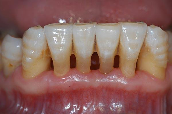 安吉最新24小时牙医在线咨询方法分析(最方便真实的安吉有没有24小时牙医方法)